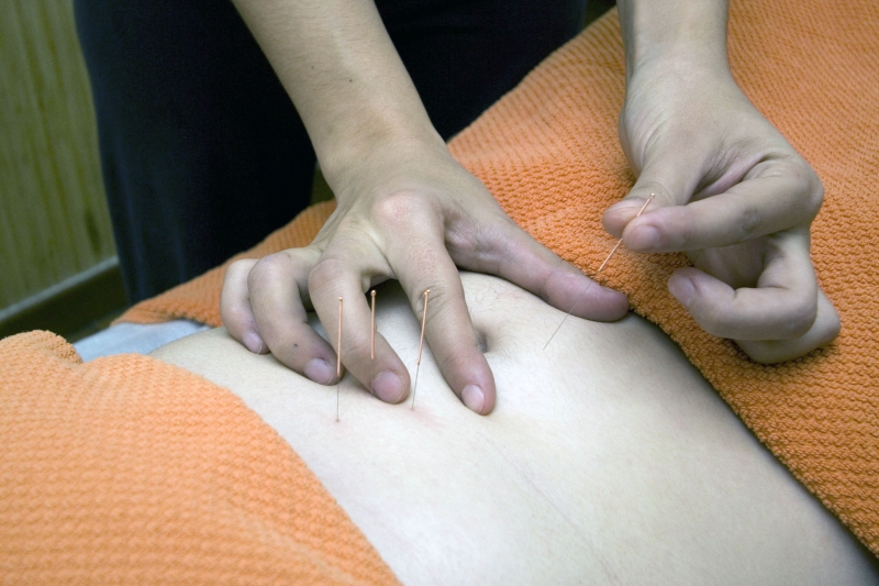 osteopathe-LA ROQUETTE SUR SIAGNE-min_acupuncture-4175625
